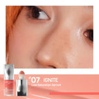 07 IGNITE